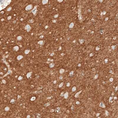 Immunohistochemistry-Paraffin: NCAM-1/CD56 Antibody (CL12732) [NBP3-18543]