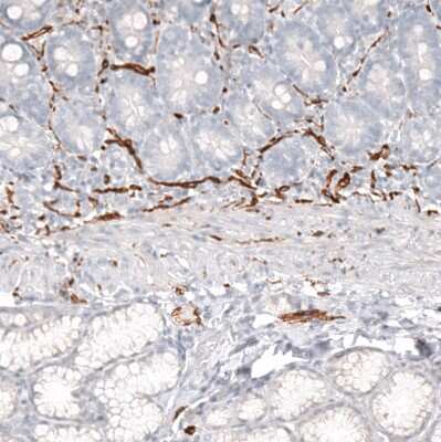 Immunohistochemistry-Paraffin: NCAM-1/CD56 Antibody (CL12732) [NBP3-18543]