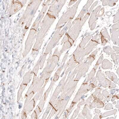 Immunohistochemistry-Paraffin: NCAM-1/CD56 Antibody (CL12732) [NBP3-18543]