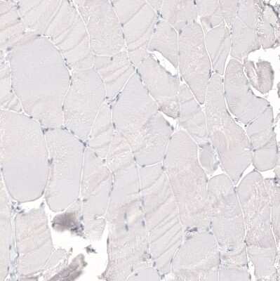 Immunohistochemistry-Paraffin: NCAM-1/CD56 Antibody (CL12732) [NBP3-18543]