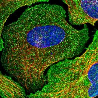 Immunocytochemistry/ Immunofluorescence: NCAM-1/CD56 Antibody [NBP2-38452]