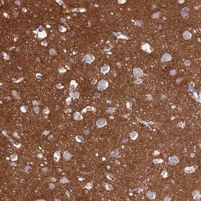 Immunohistochemistry-Paraffin: NCAM-1/CD56 Antibody [NBP2-38452]