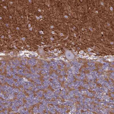 Immunohistochemistry-Paraffin: NCAM-1/CD56 Antibody [NBP2-38452]