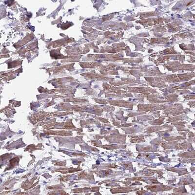 Immunohistochemistry-Paraffin: NCAM-1/CD56 Antibody [NBP2-38452]