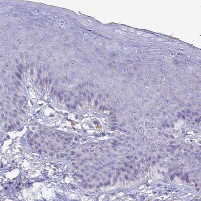 Immunohistochemistry-Paraffin: NCAM-1/CD56 Antibody [NBP2-38452]