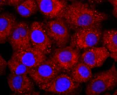 Immunocytochemistry/ Immunofluorescence: NCAM-1/CD56 Antibody (JF1021) [NBP2-66968]