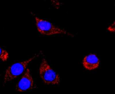 Immunocytochemistry/ Immunofluorescence: NCAM-1/CD56 Antibody (JF1021) [NBP2-66968]