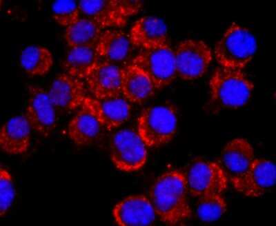 Immunocytochemistry/ Immunofluorescence: NCAM-1/CD56 Antibody (JF1021) [NBP2-66968]