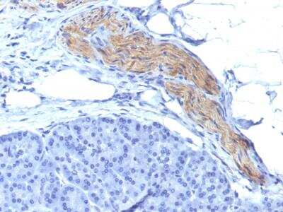 Immunohistochemistry-Paraffin: NCAM-1/CD56 Antibody (NCAM1/795) - IHC-Prediluted [NBP2-48193]