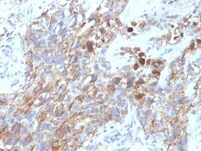 Immunohistochemistry-Paraffin: NCAM-1/CD56 Antibody (NCAM1/795) [NBP2-44717]