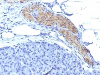 Immunohistochemistry-Paraffin: NCAM-1/CD56 Antibody (NCAM1/795) [NBP2-44717]