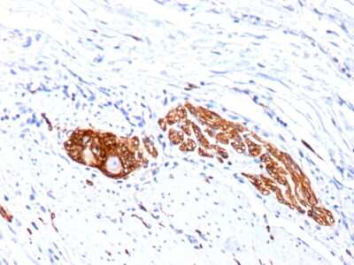 Immunohistochemistry-Paraffin: NCAM-1/CD56 Antibody (SPM128) [NBP2-34349]