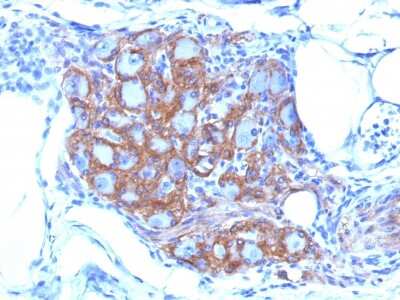 Immunohistochemistry-Paraffin: NCAM-1/CD56 Antibody (SPM128) [NBP2-34349]