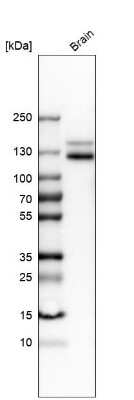 Western Blot: NCAM-1/CD56 Antibody [NBP2-38452]