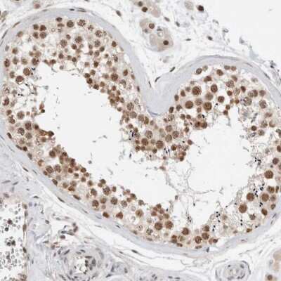 Immunohistochemistry-Paraffin: NCAPG2 Antibody [NBP1-86633]