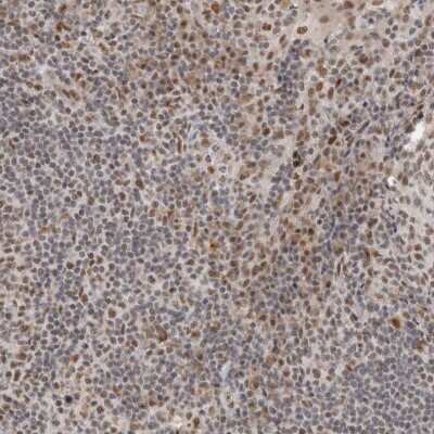 Immunohistochemistry-Paraffin: NCAPG2 Antibody [NBP1-86633]