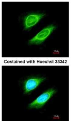 Immunocytochemistry/ Immunofluorescence: NCAPH Antibody [NBP1-32573]