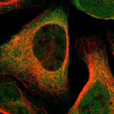 Immunocytochemistry/ Immunofluorescence: NCAPH Antibody [NBP1-88345]