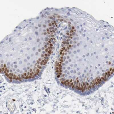 Immunohistochemistry-Paraffin: NCAPH Antibody [NBP1-88345]