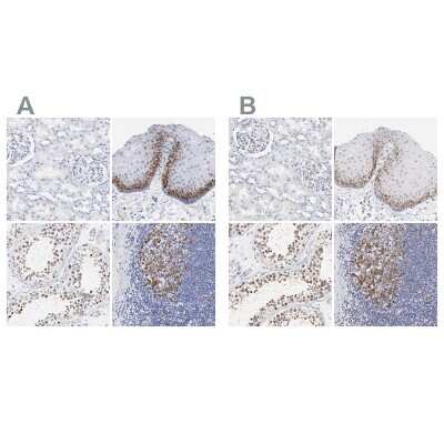 Immunohistochemistry-Paraffin: NCAPH Antibody [NBP1-88345]