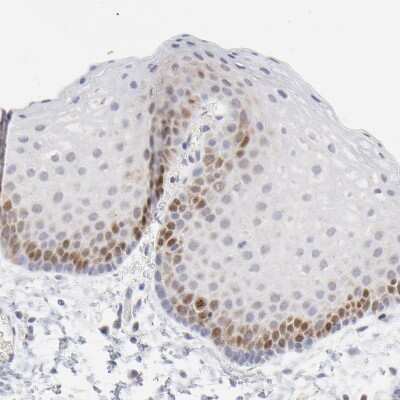 Immunohistochemistry-Paraffin: NCAPH Antibody [NBP1-88346]