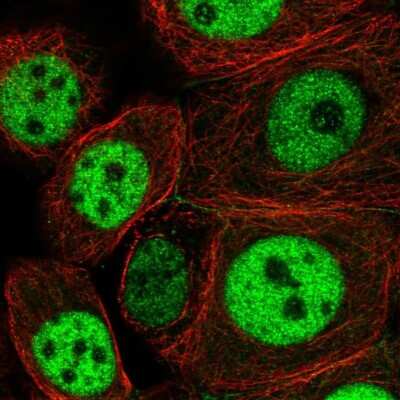 Immunocytochemistry/ Immunofluorescence: NCAPH2 Antibody [NBP2-49580]