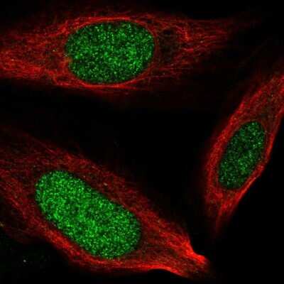 Immunocytochemistry/ Immunofluorescence: NCAPH2 Antibody [NBP2-57498]