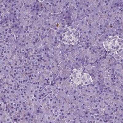 Immunohistochemistry-Paraffin: NCAPH2 Antibody [NBP2-49580]