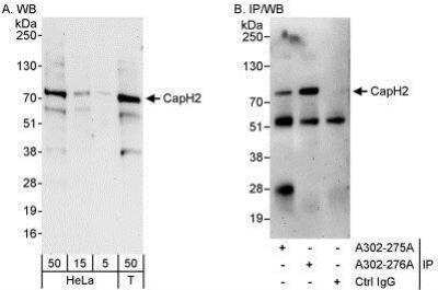 Western Blot: NCAPH2 Antibody [NBP1-28723]