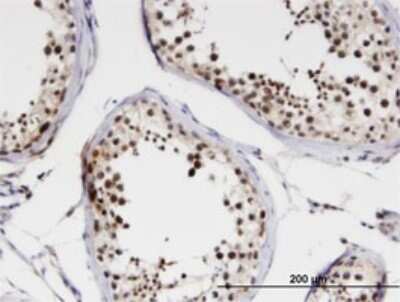 Immunohistochemistry-Paraffin: NCBP1 Antibody (1E9) [H00004686-M04]