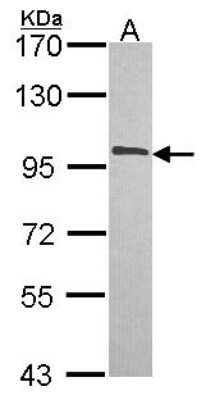 Western Blot: NCBP1 Antibody [NBP2-19484]