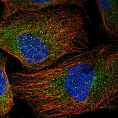 Immunocytochemistry/ Immunofluorescence: UBE2F/NCE2 Antibody [NBP1-92169]