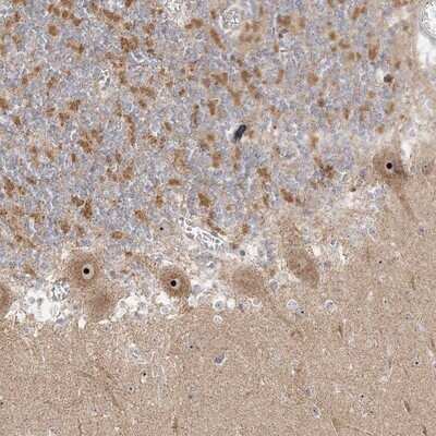 Immunohistochemistry-Paraffin: UBE2F/NCE2 Antibody [NBP1-92169]