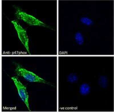 Immunocytochemistry/ Immunofluorescence: NCF1 Antibody [NBP2-26113]