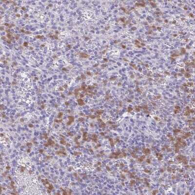 Immunohistochemistry-Paraffin: NCF1 Antibody [NBP2-33502]