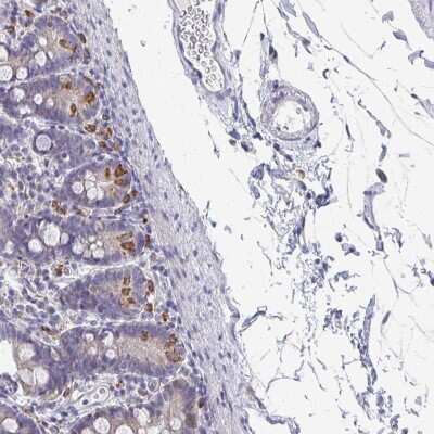 Immunohistochemistry-Paraffin: NCF1 Antibody [NBP2-33638]