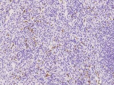 Immunohistochemistry-Paraffin: NCF1 Antibody [NBP2-98530]