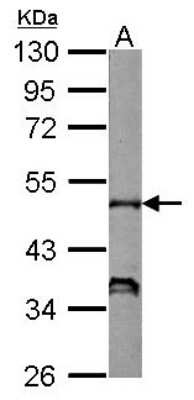Western Blot: NCF1 Antibody [NBP2-19487]