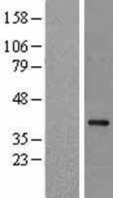 Western Blot: NCF4 Overexpression Lysate [NBL1-13511]