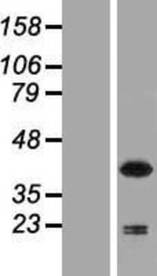 Western Blot: NCF4 Overexpression Lysate [NBP2-09005]