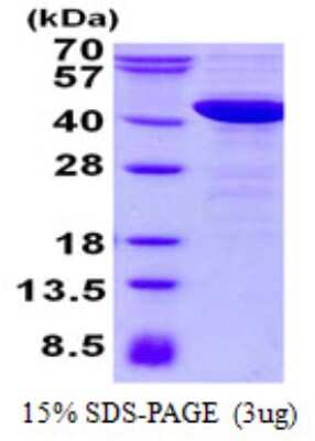 SDS-PAGE: Recombinant Human NCF4 His Protein [NBP2-23284]