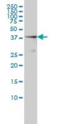 Western Blot: NCK1 Antibody (1A1) [H00004690-M01]