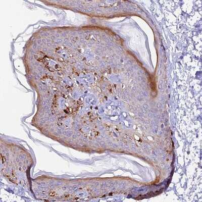 Immunohistochemistry-Paraffin: NCK2 Antibody [NBP1-82592]