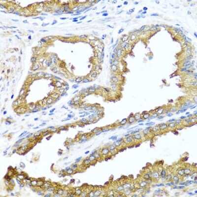 Immunohistochemistry-Paraffin: NCK2 Antibody - BSA Free [NBP2-93503]