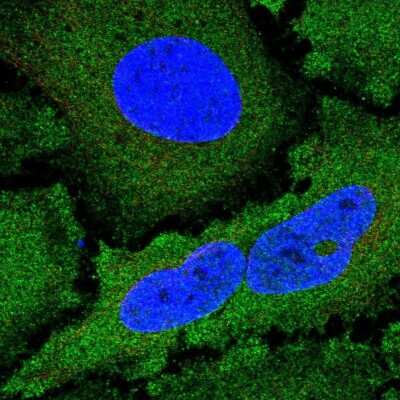 Immunocytochemistry/ Immunofluorescence: NCKIPSD Antibody [NBP2-56886]