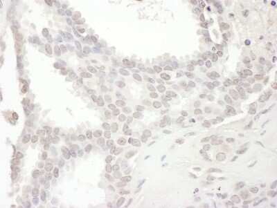 Immunohistochemistry: NCKIPSD Antibody [NBP1-42664]