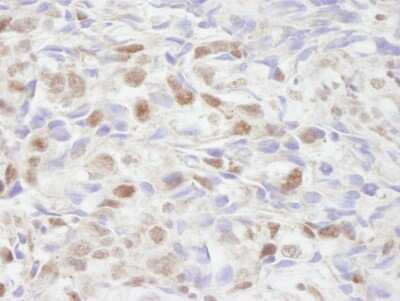 Immunohistochemistry: NCOA2 Antibody [NB100-1756]