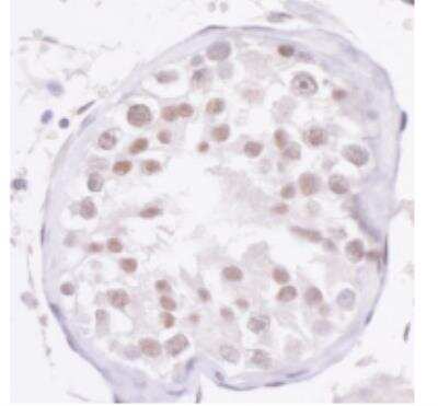 Immunohistochemistry-Paraffin: NCOA2 Antibody [NBP2-22162]