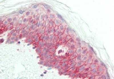 Immunohistochemistry: NCOA3/AIB1 Antibody [NBP1-77785]