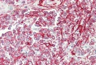 Immunohistochemistry: NCOA3/AIB1 Antibody [NBP1-77785]